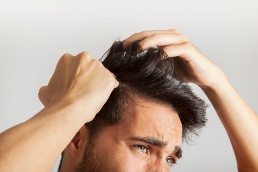 hormonas pueden provocar la caída del cabello
